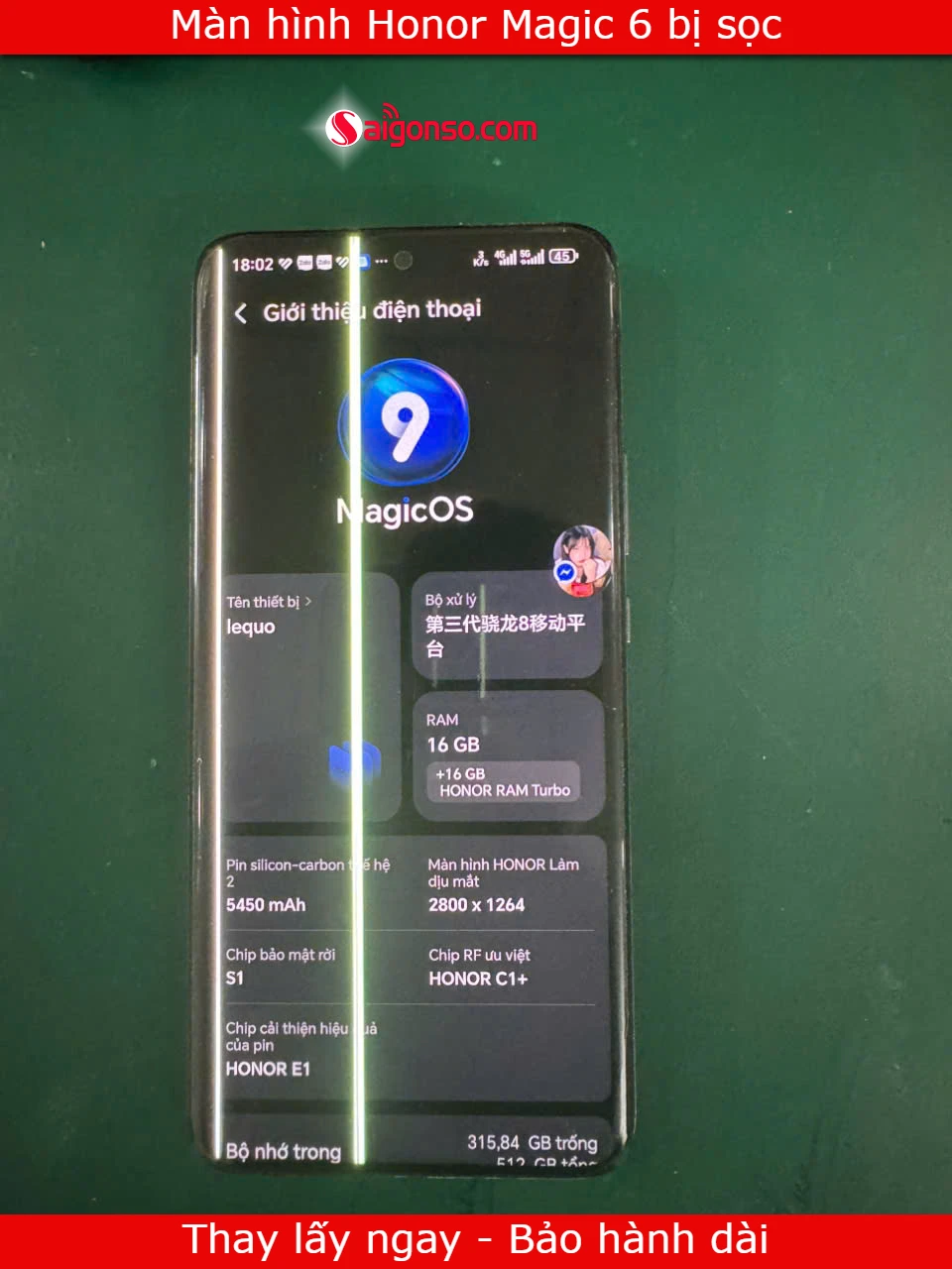 Màn hình Honor Magic 6 Pro bị sọc
